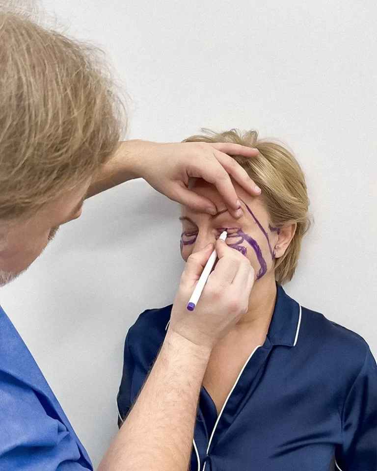 Planificarea unui Deep Plane Facelift la AMOO Klinik București