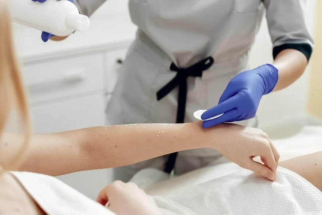 Epilare definitivă cu Splendor X clinica AMOO