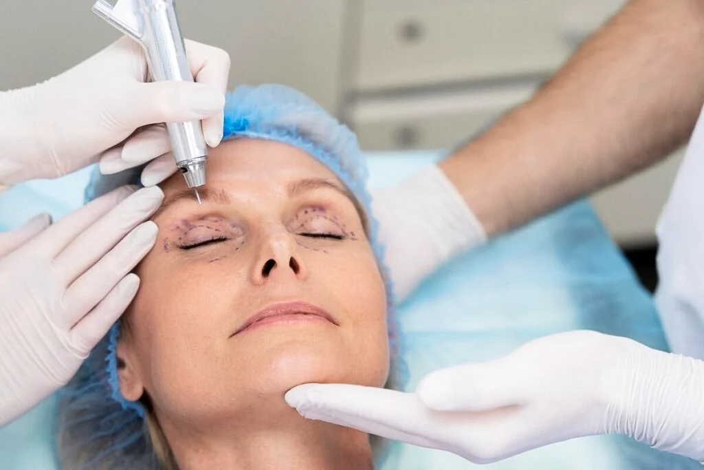 Etapele procedurii chirurgicale de blefaroplastie la AMOO Klinik