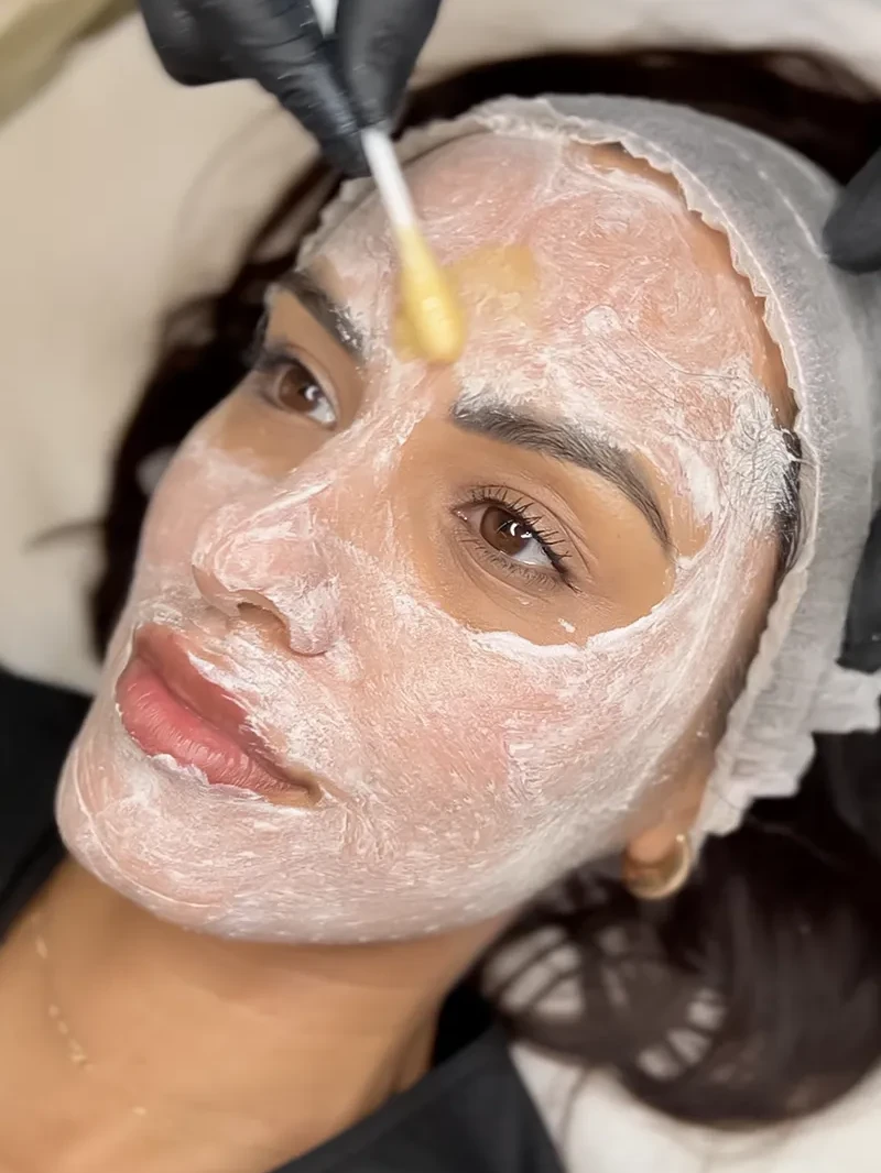 Cosmetolog pregătind un peeling superficial la AMOO Klinik