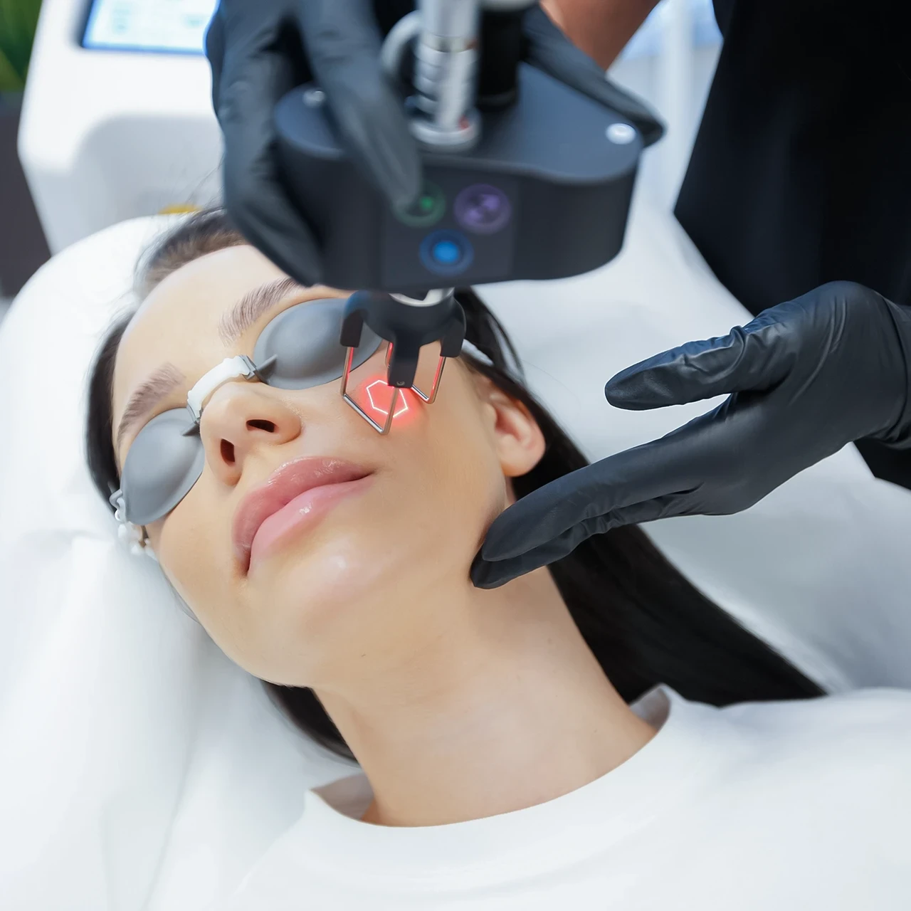 Consultație și tratament dermatologic la AMOO Klinik București