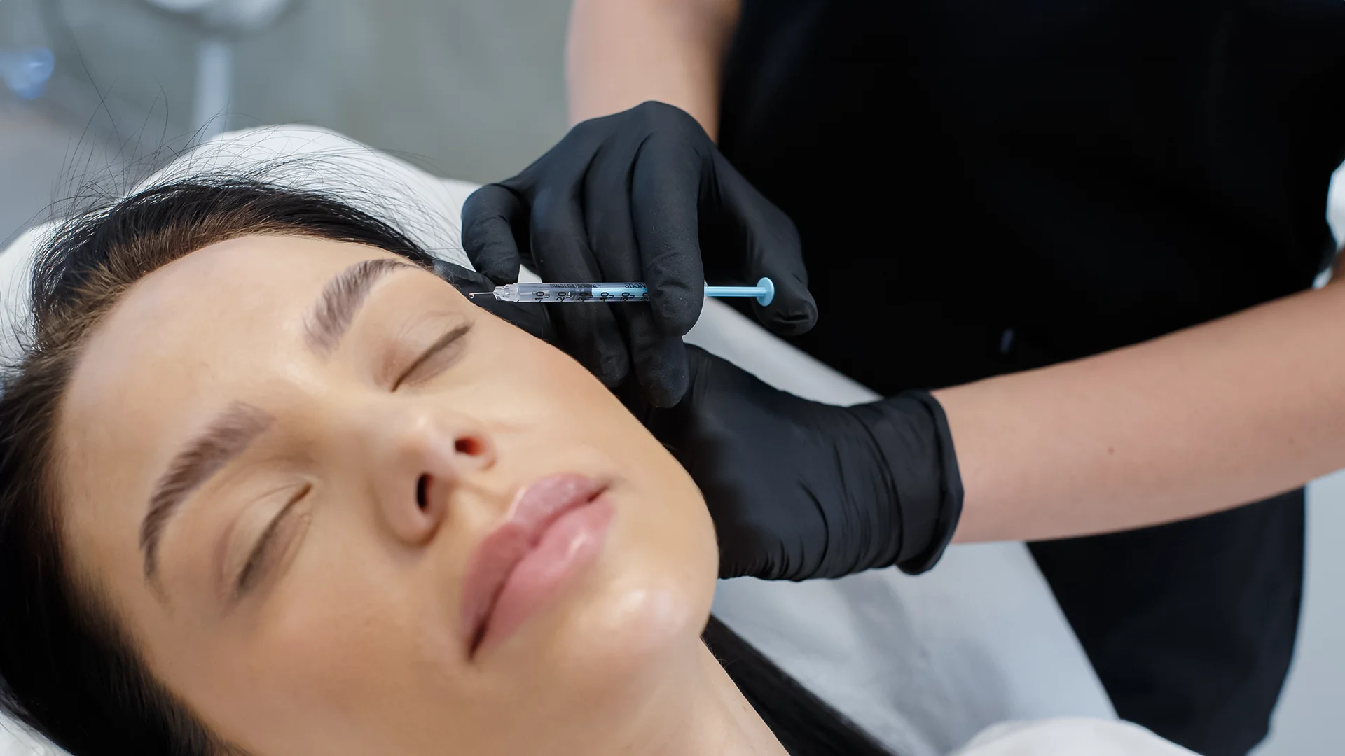 Tratament cu toxină botulinică pentru ridurile dinamice, realizat la AMOO Klinik București