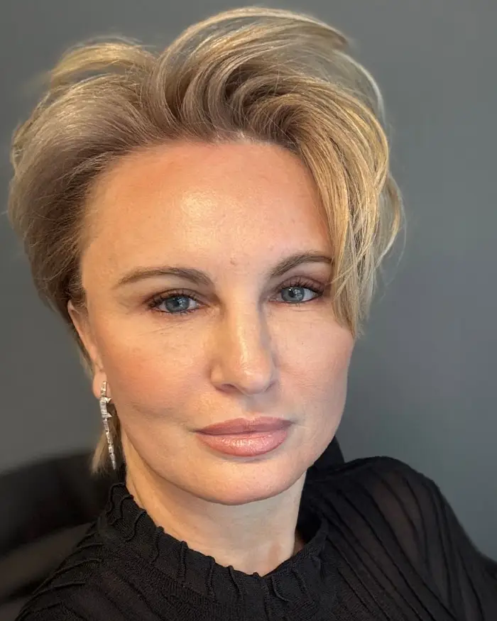 Deep Plane Facelift Amoo Klinik - dupa procedură